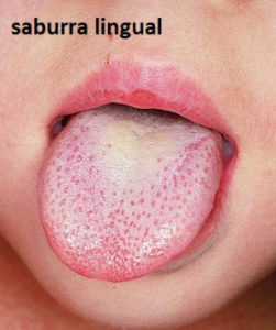 saburra-lingual