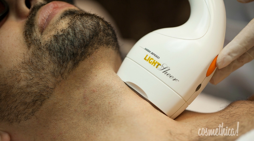 depilacao a laser em barba